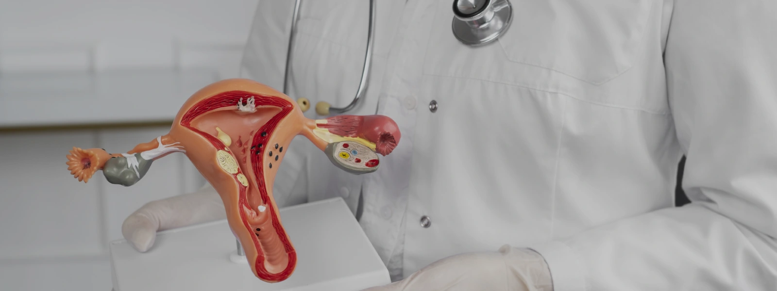 cinsel ilişkiden sonra hamile kalmamak için doğal yöntemler