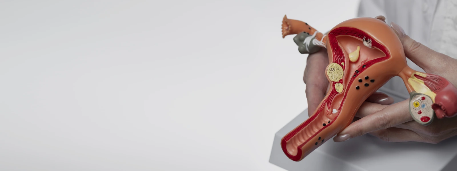 ovulasyon döneminde kahverengi akıntı